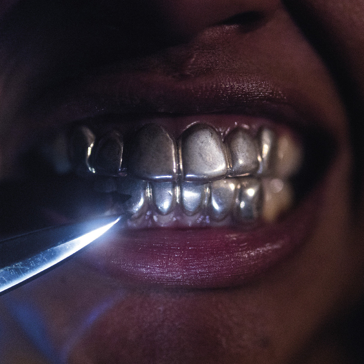 Close-up of a person's mouth with a metal grill on their teeth.