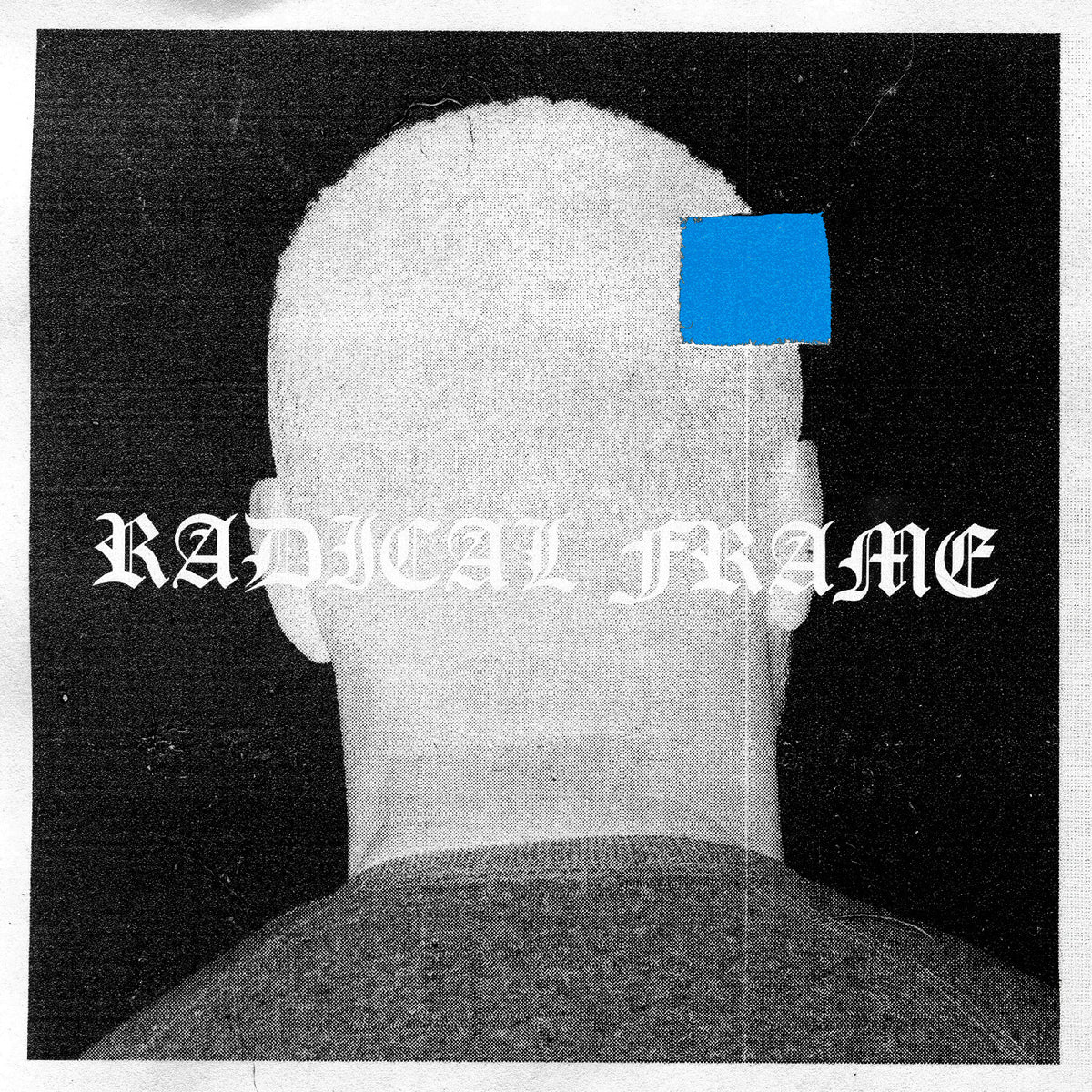 Album cover art for 'RADICAL FRAME' featuring a grainy black-and-white back view of a bald man's head and shoulders, with a bright blue square sticker covering part of his scalp and gothic white text across the center.