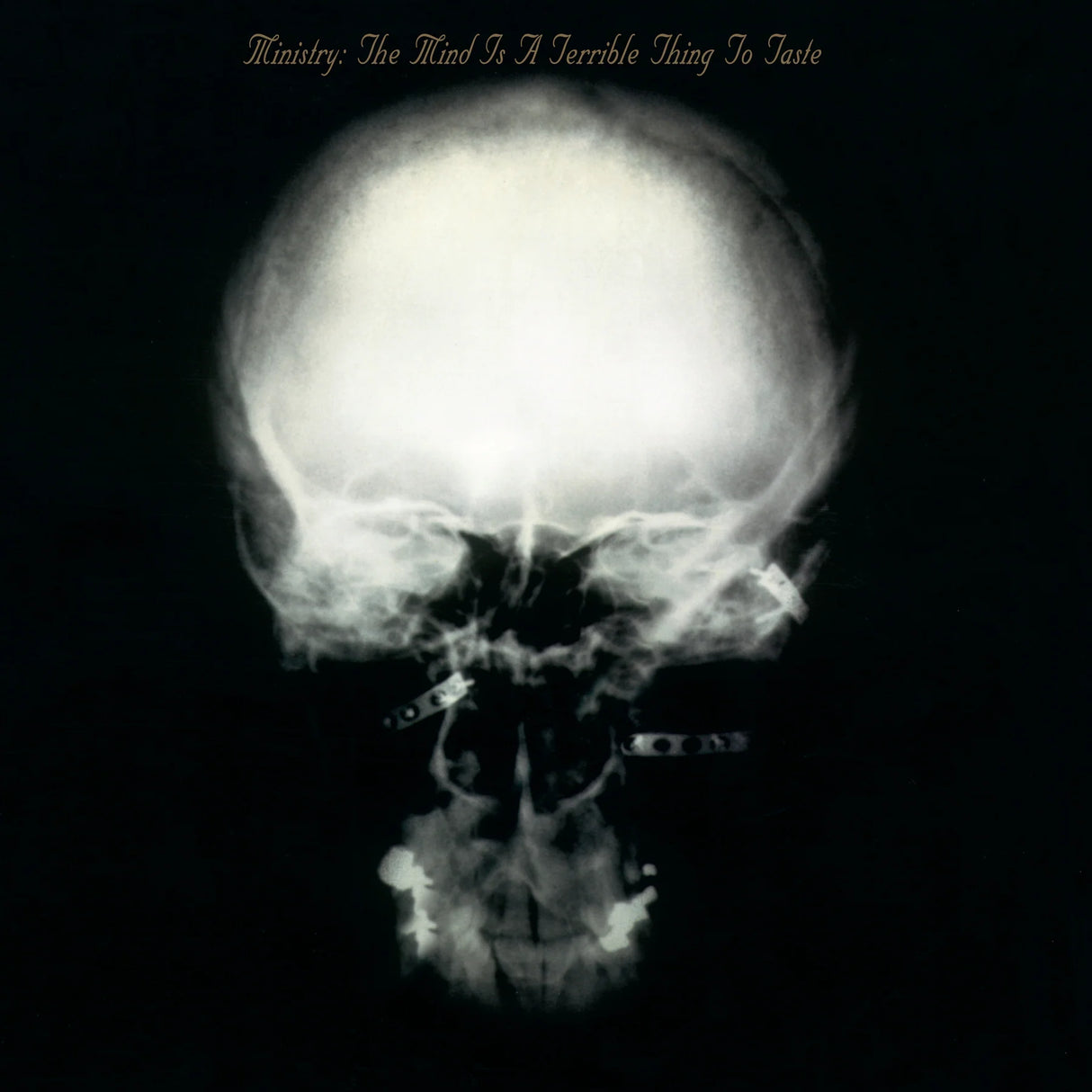 X-ray of a skull on a black background with text