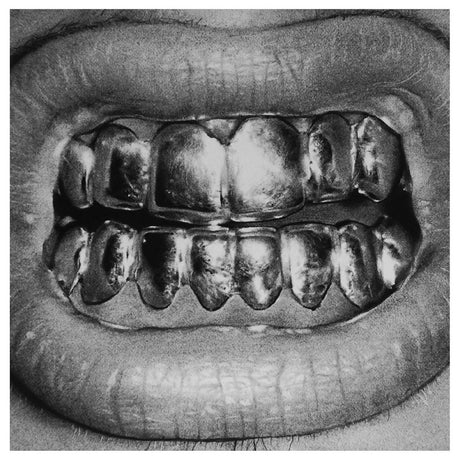 Close-up of a mouth with metallic grills on teeth
